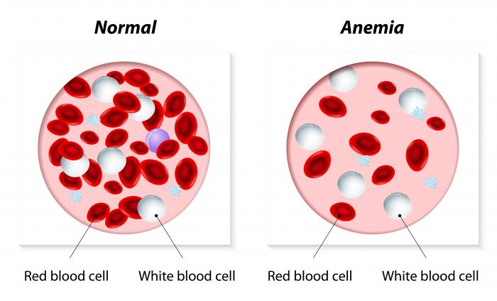 Anemia Causes Symptoms And Treatments Medical News Today 4280