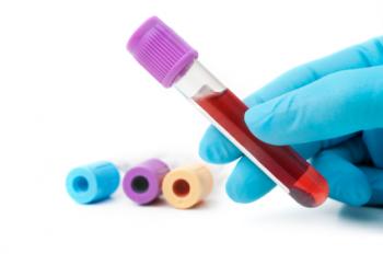 A blood test