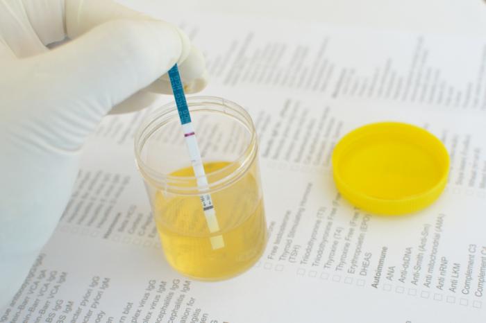 urine 

sample