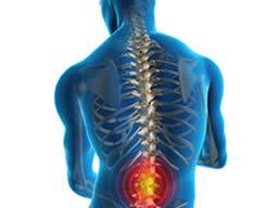 All about ankylosing spondylitis