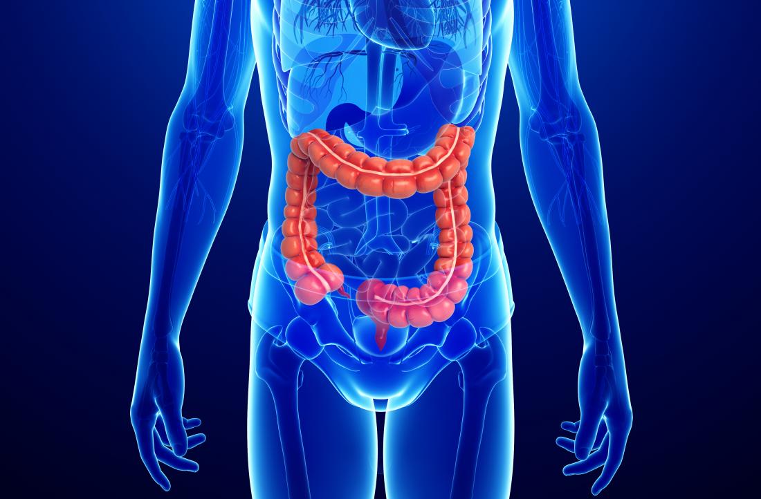Crohn's disease vs. ulcerative colitis: What is the ... diagram of colitis 