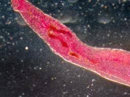 Salmonella: Symptoms, causes, and treatment