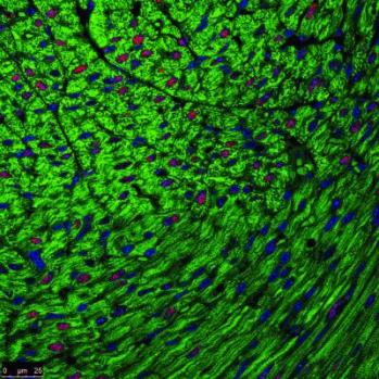 Extensive Cardiomyocyte Mitoses in Postnatal-day-15 Left Cardiac Ventricle